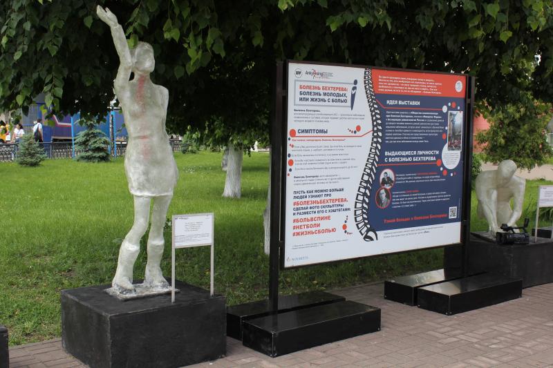 В Курске открылась выставка скульптур «Болезнь молодых, или жизнь с болью»